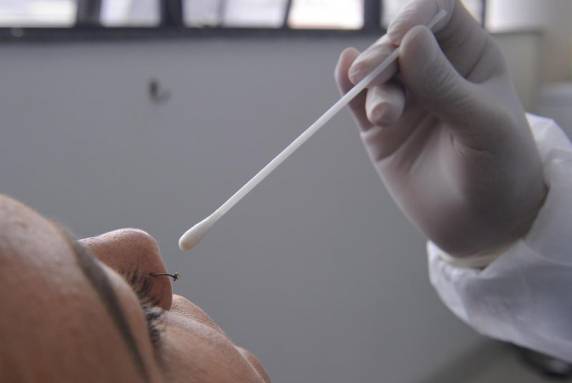 Internações de pacientes infectados também apresentam queda, mas mais discreta: redução é de 32,3%